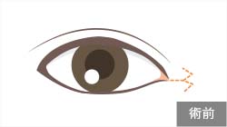 Wの形にデザイン