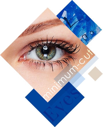 ミニマムカット法（脱脂+埋没法）