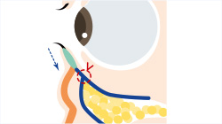 施術終了後に注意事項の説明をする
