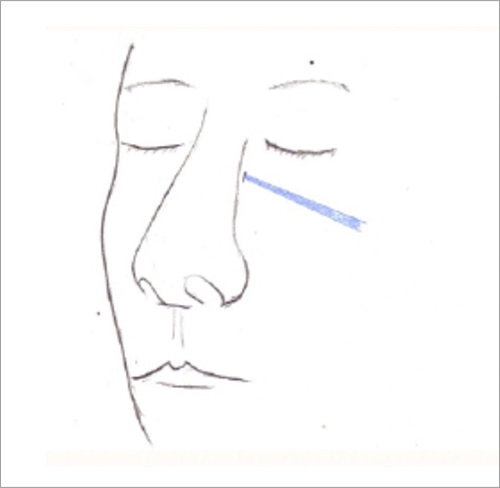 簡単な施術の流れ