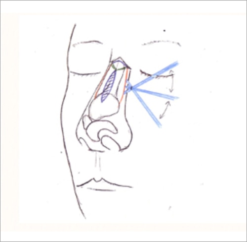 簡単な施術の流れ