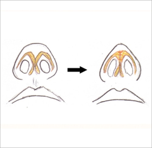 簡単な施術の流れ