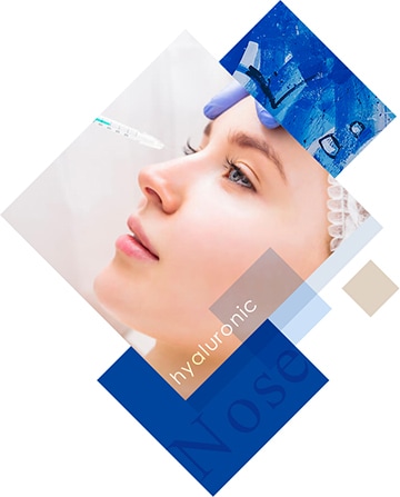 ヒアルロン酸注入