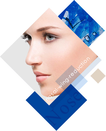 鼻翼縮小・挙上術