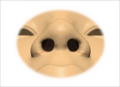 簡単な施術の流れ