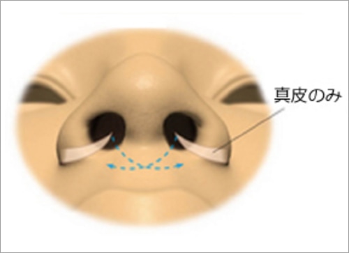 簡単な施術の流れ