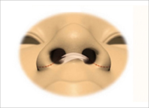 簡単な施術の流れ