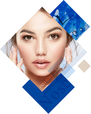 鼻翼縮小・挙上術