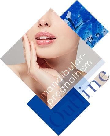 下顎前突症(受け口)