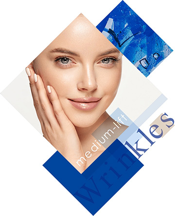 ミディアムリフト