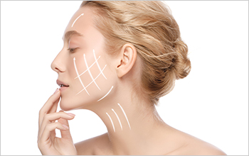 ミニリフトとは?