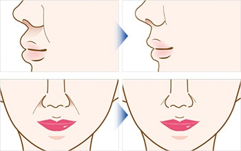 美しさは、数ミリで変えられます。