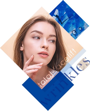 フェイスリフト(リガメント法)